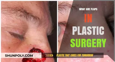 Understanding Flaps in Plastic Surgery: Techniques, Benefits, and Applications