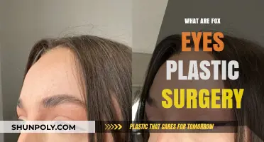 Fox Eyes Plastic Surgery: Understanding the Trendy Aesthetic Procedure
