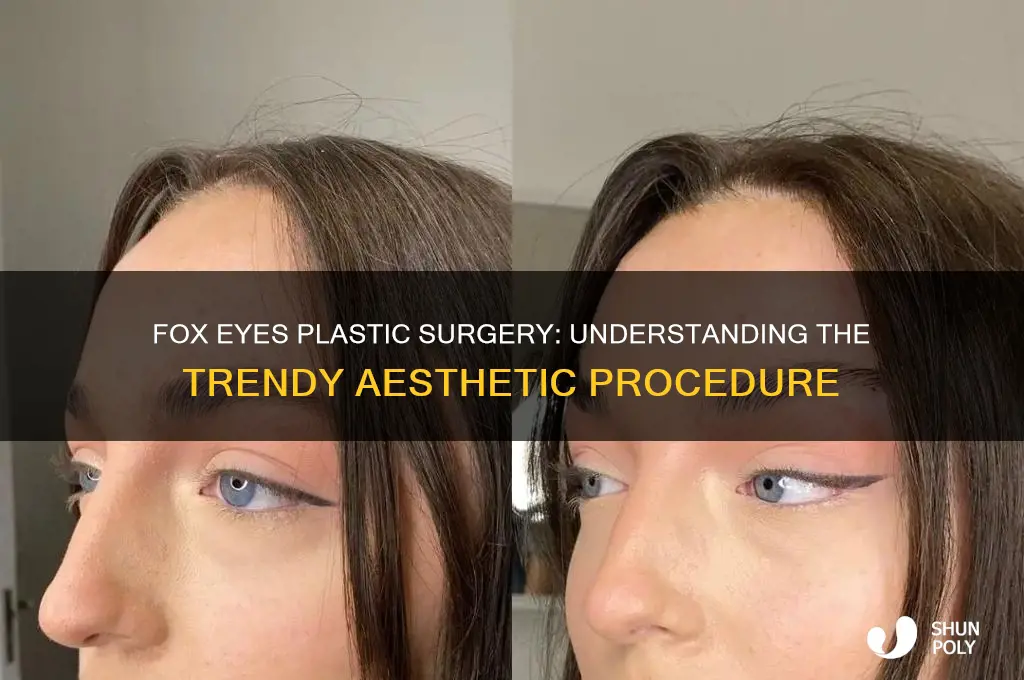 what are fox eyes plastic surgery