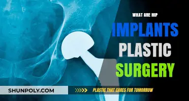 Understanding Hip Implants: A Comprehensive Guide to Plastic Surgery Options