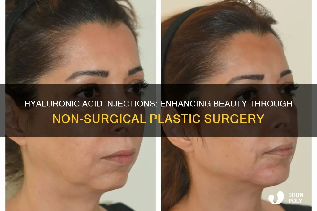 what are hyaluronic acid injections plastic surgery