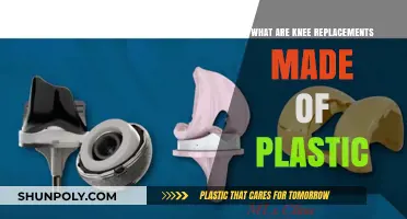 Are Knee Replacements Made of Plastic? Materials Explained