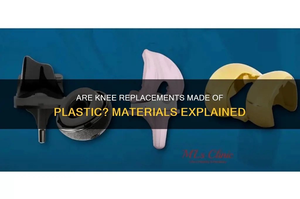what are knee replacements made of plastic