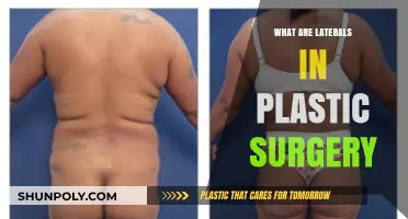 Understanding Laterals: Their Role and Impact in Plastic Surgery Procedures
