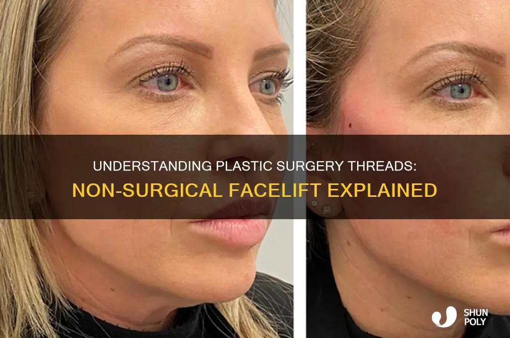 what are plastic surgery threads
