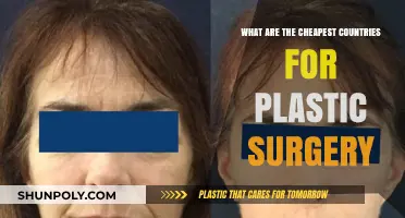 Affordable Beauty Destinations: Top Countries for Budget-Friendly Plastic Surgery