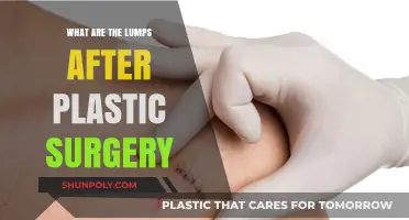 Understanding Post-Plastic Surgery Lumps: Causes, Concerns, and Solutions