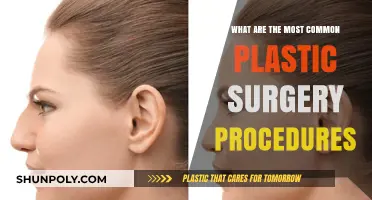 Exploring the Most Popular Plastic Surgery Procedures Today