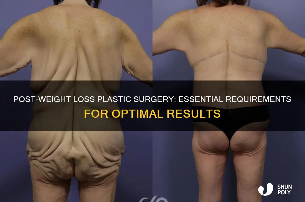 what are the requirements for plastic surgery after weight loss