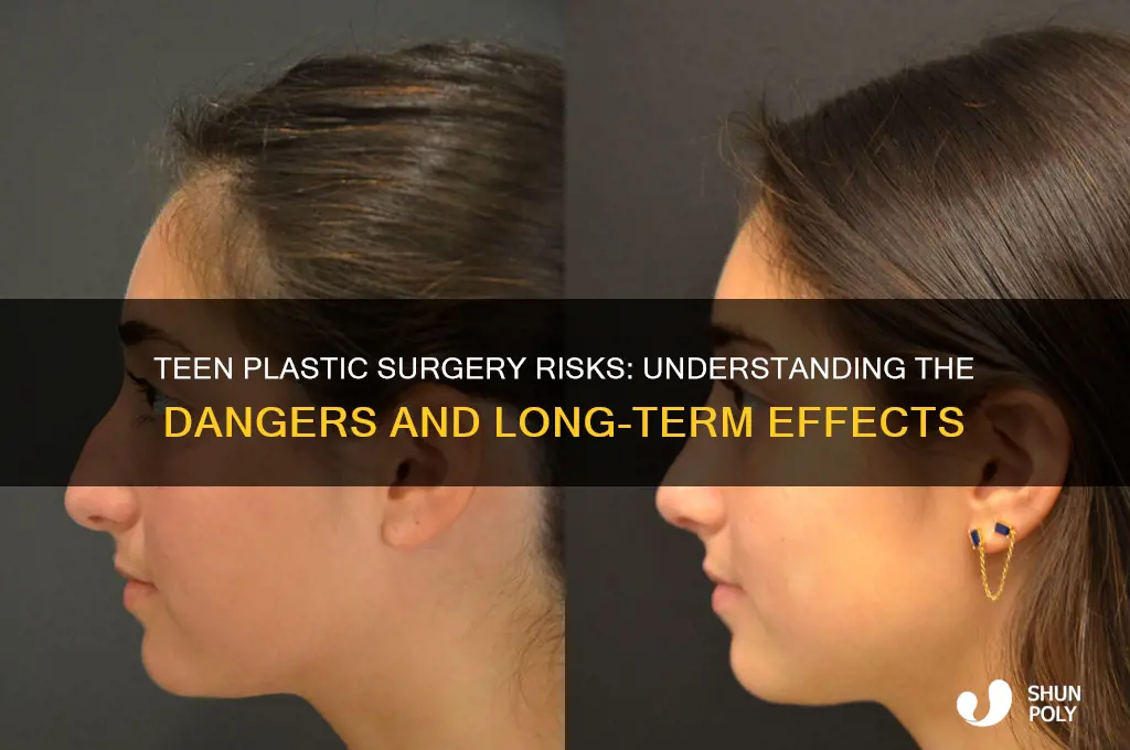 what are the risk of plastic surgery for teens