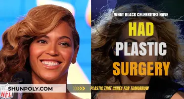 Plastic Surgery Revelations: Black Celebrities Who've Gone Under the Knife