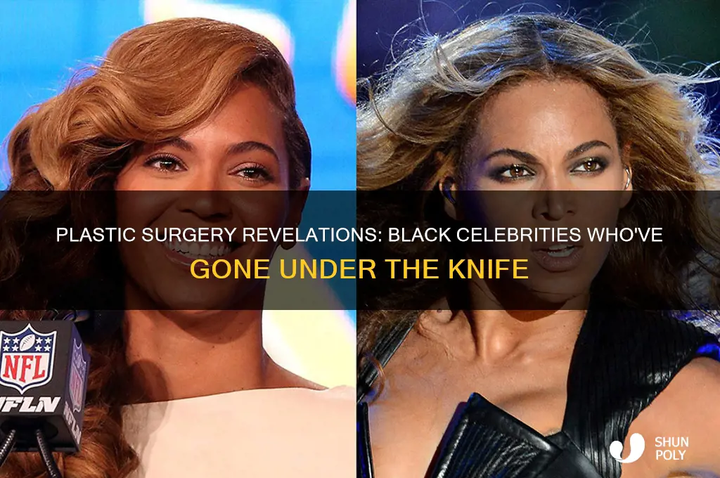 what black celebrities have had plastic surgery