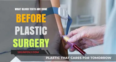 Essential Blood Tests Required Before Undergoing Plastic Surgery Procedures