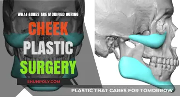 Cheek Plastic Surgery: Understanding the Modified Facial Bones