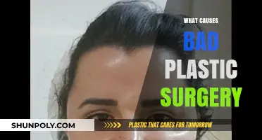 Unveiling the Root Causes of Botched Plastic Surgery Procedures