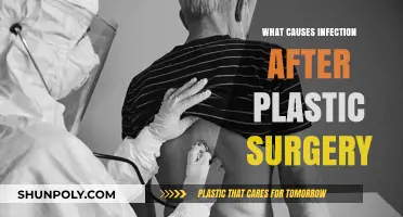 Understanding Post-Surgical Infections: Causes and Prevention After Plastic Surgery