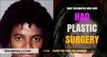 Famous Men Who've Gone Under the Knife: Plastic Surgery Secrets