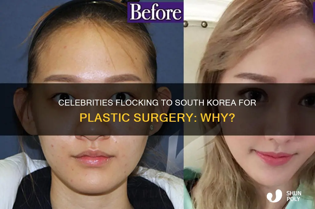what celebrities go to south korea for plastic surgery