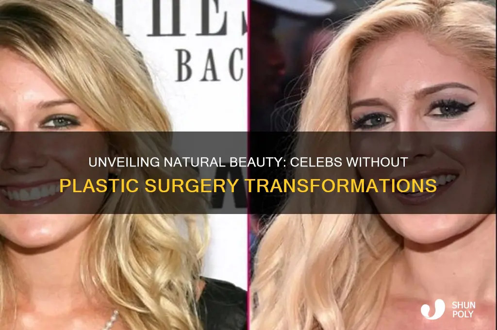 what celebs would look like without plastic surgery