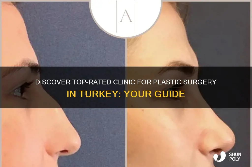 what clinic plastic surgery turkey