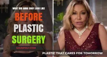 Anna Shay's Pre-Surgery Appearance: Unveiling Her Natural Beauty Transformation