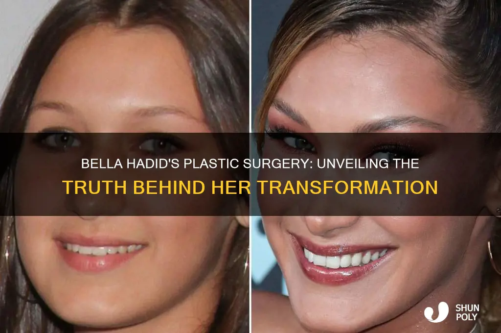 what did bella hadid plastic surgery