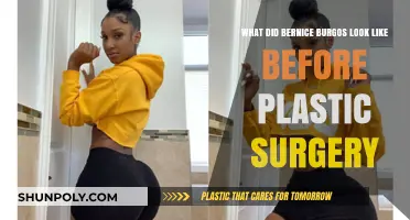 Bernice Burgos' Pre-Surgery Look: Unveiling Her Natural Beauty Transformation