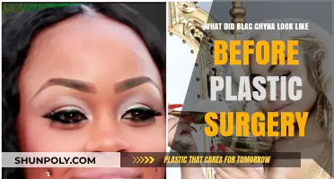 Blac Chyna's Transformation: Unveiling Her Pre-Plastic Surgery Appearance