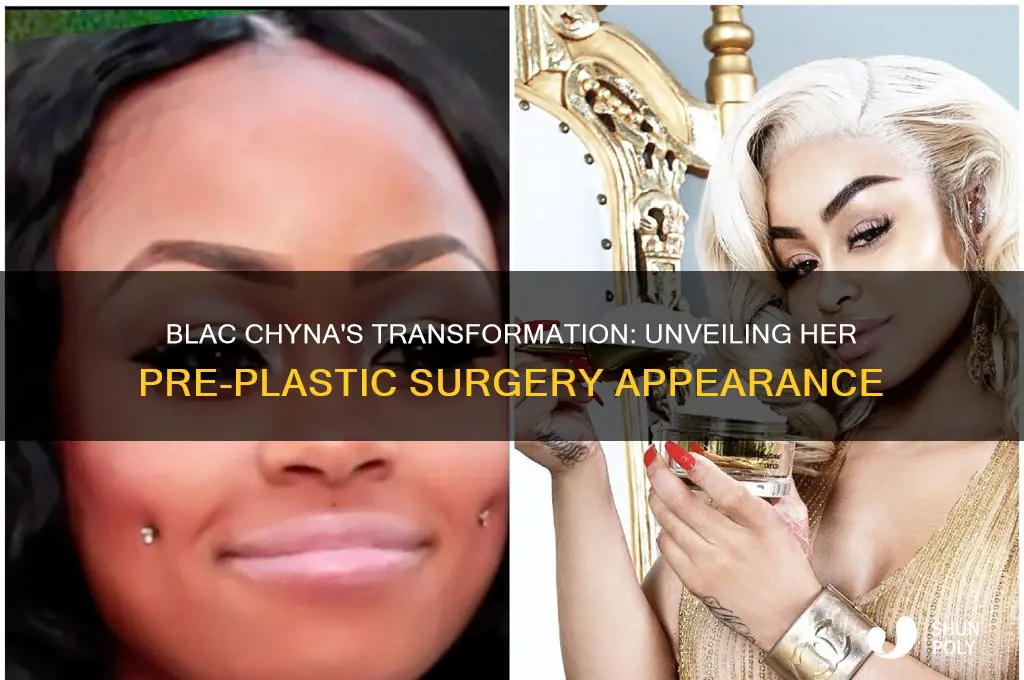 what did blac chyna look like before plastic surgery