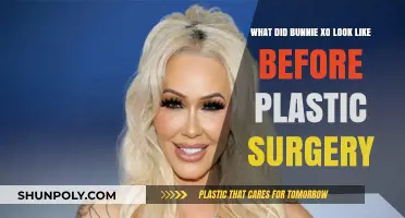 Bunnie XO's Pre-Surgery Transformation: Unveiling Her Natural Look