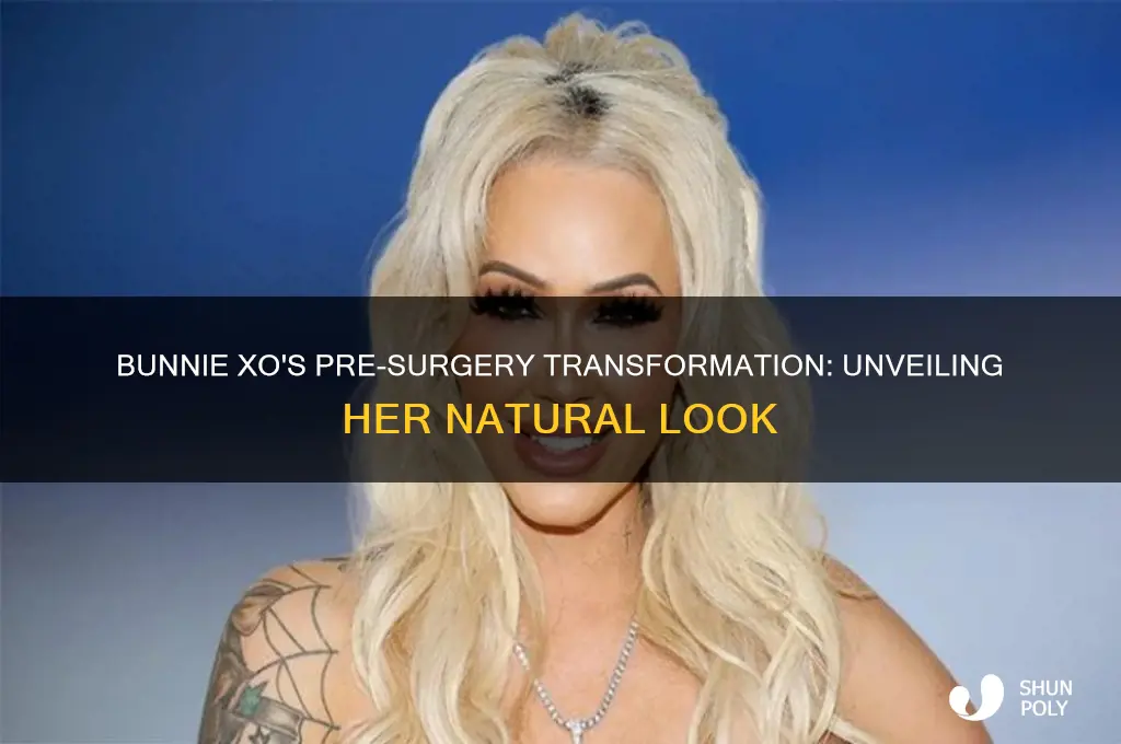 what did bunnie xo look like before plastic surgery