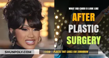 Cardi B's Post-Plastic Surgery Transformation: A Stunning New Look