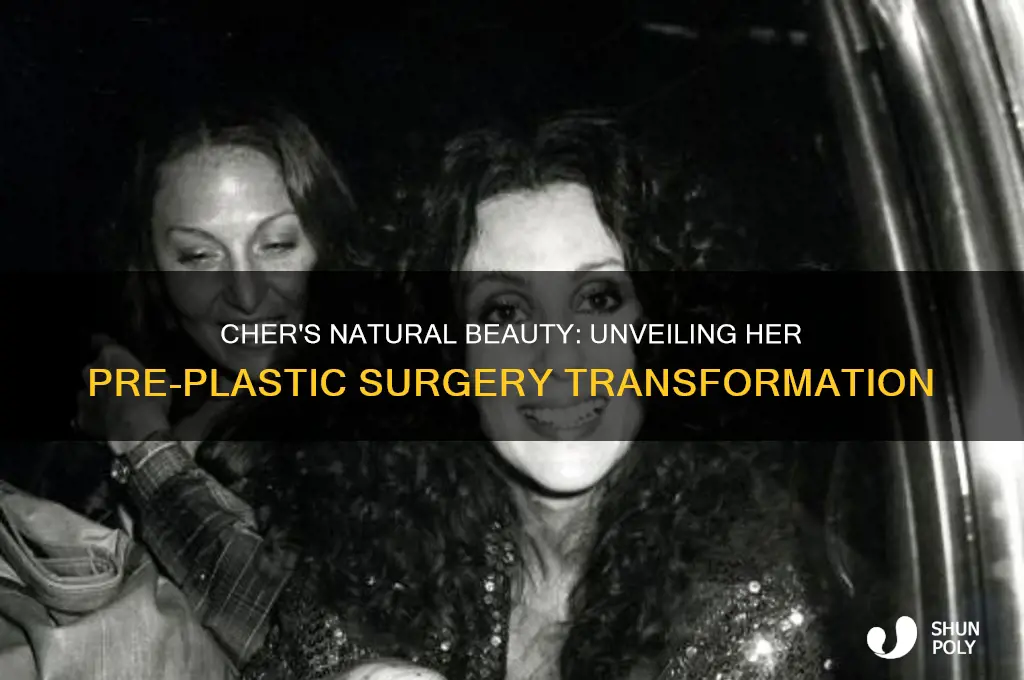 what did cher look like before plastic surgery