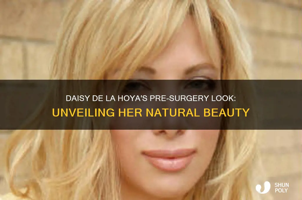 what did daisy delahoya look like before plastic surgery