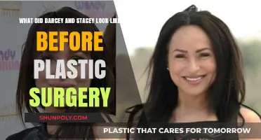 Darcey and Stacey's Pre-Surgery Transformation: Unveiling Their Original Look