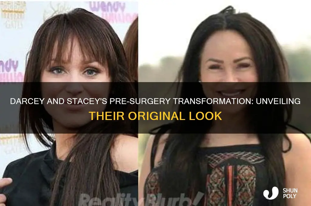 what did darcey and stacey look like before plastic surgery