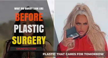 Darcey's Transformation: Unveiling Her Pre-Plastic Surgery Appearance
