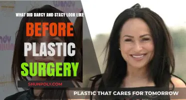 Darcy and Stacy's Pre-Plastic Surgery Looks: Unveiling Their Original Appearance