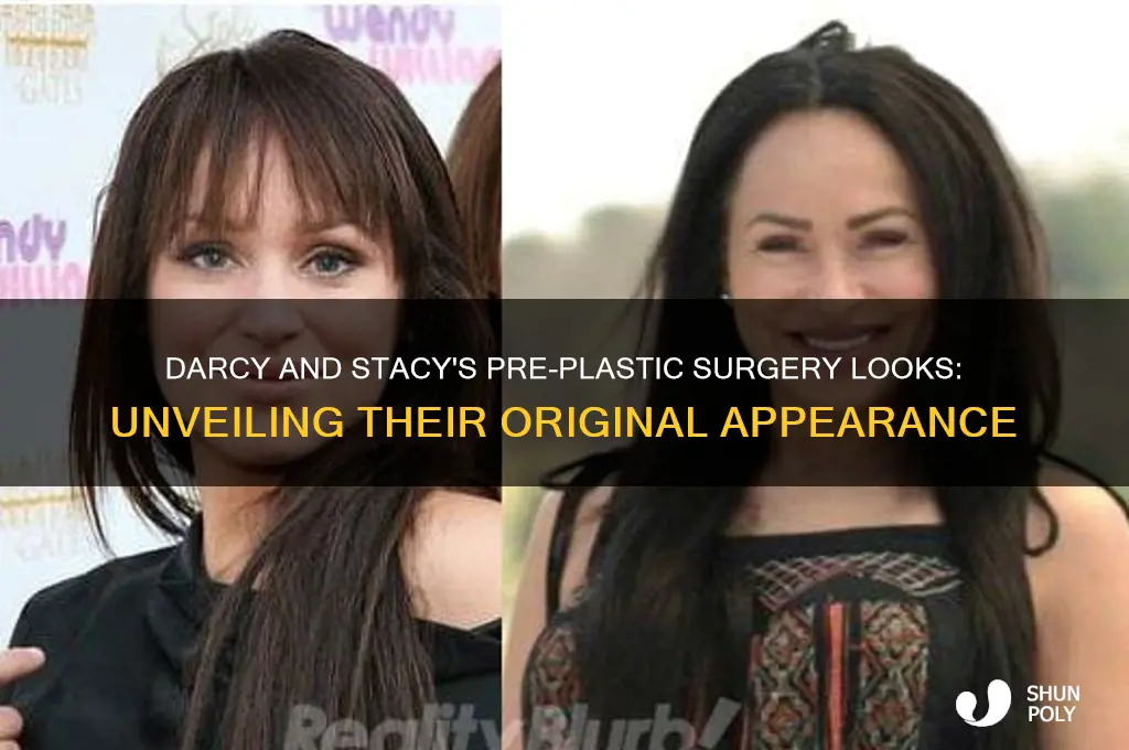 what did darcy and stacy look like before plastic surgery