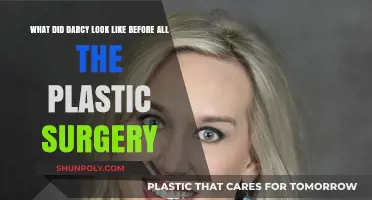 Unveiling Darcy's Original Look: Pre-Plastic Surgery Transformation Revealed