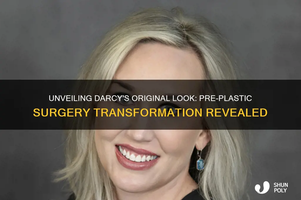 what did darcy look like before all the plastic surgery