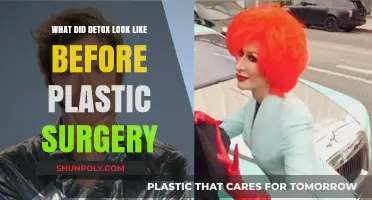 Detox's Pre-Plastic Surgery Transformation: Unveiling Her Natural Look