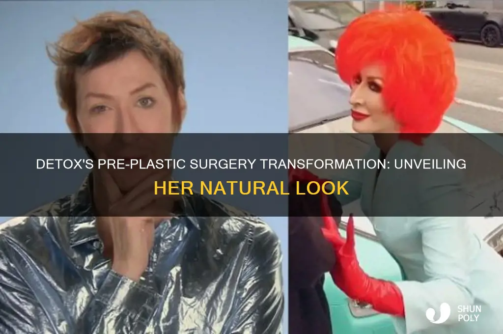 what did detox look like before plastic surgery
