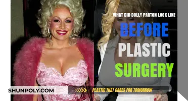 Dolly Parton's Pre-Surgery Transformation: Unveiling Her Natural Beauty