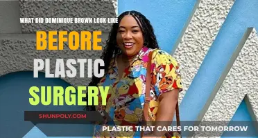 Dominique Brown's Pre-Surgery Appearance: Unveiling Her Natural Look