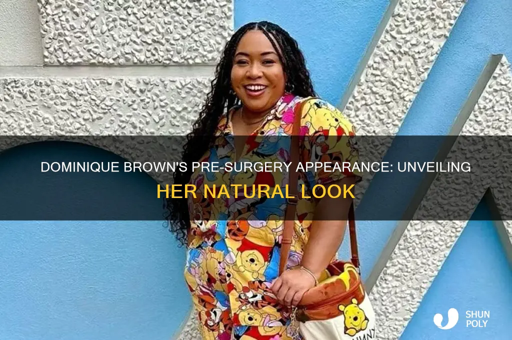 what did dominique brown look like before plastic surgery