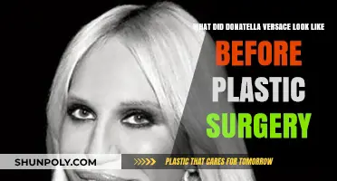 Donatella Versace's Pre-Surgery Transformation: Unveiling Her Original Look