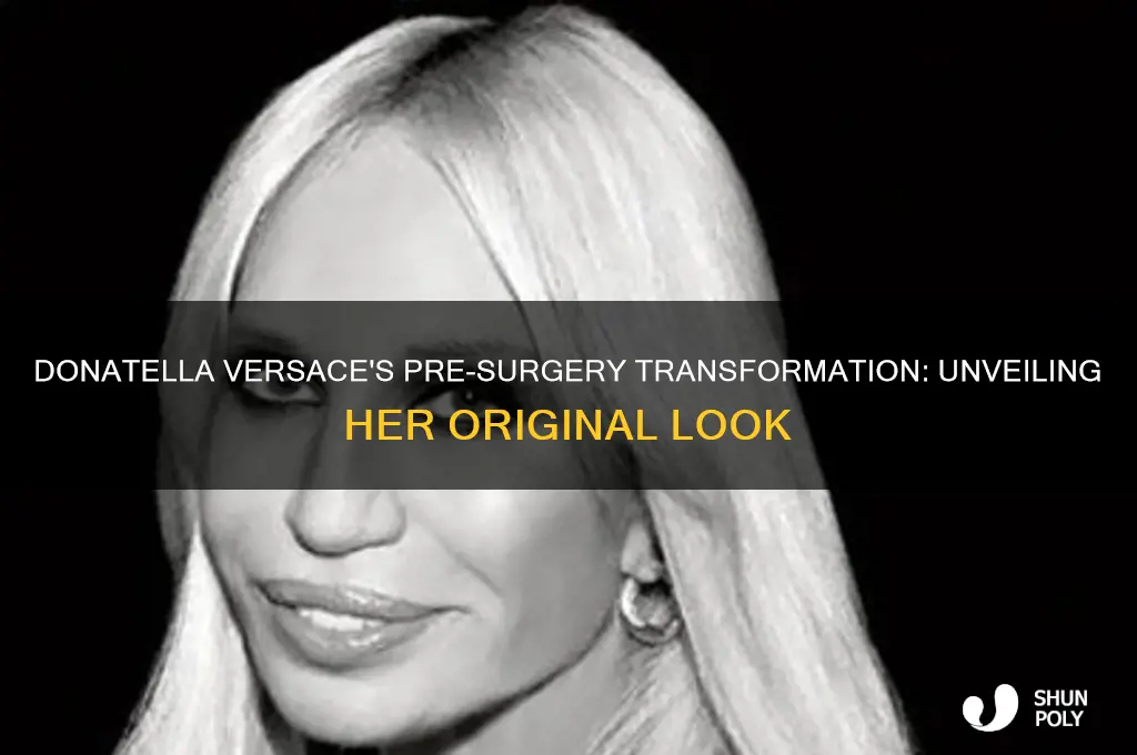 what did donatella versace look like before plastic surgery