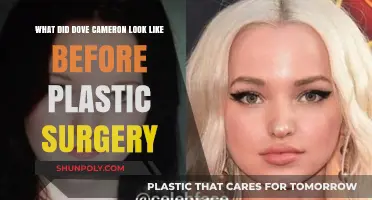 Dove Cameron's Transformation: Pre-Surgery Look Revealed