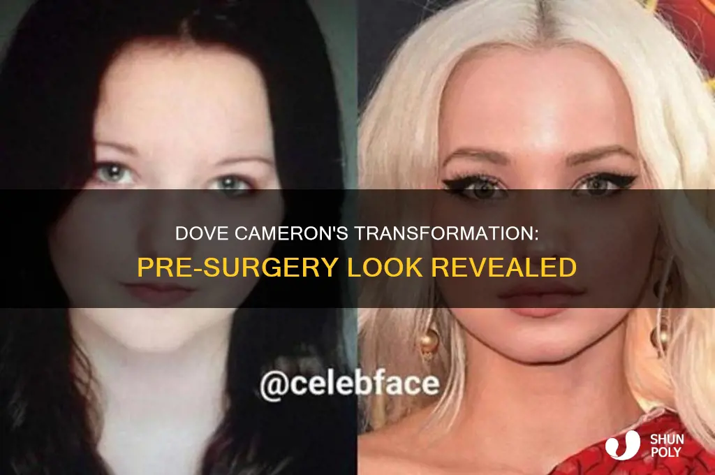 what did dove cameron look like before plastic surgery